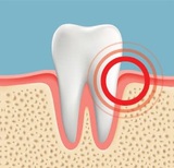 Gum Pain Causes, Relief, and Treatments