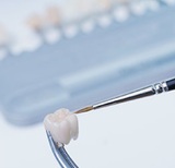 What is a Dental Crown? Costs and Types