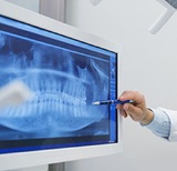 What is a Root Canal? - Pain, Procedure, & Cost