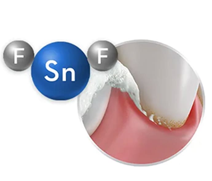 Bad Breath Causes