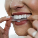 Affordable and Cheap Teeth Whitening Options
