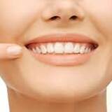 Natural Teeth Whitening Options: Are they Effective?